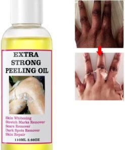 MOOYAM Yellow Peeling Oil 110ml Super Strength Dead Skin Remover Skin Moisturizing Hydrating Butter Peeling Skin Whitening Peeling Solution for Dull Skin and Uneven Skin Tone