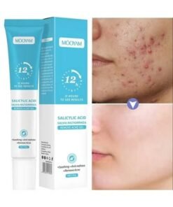 MOOYAM Salicylic Acid Salvia Miltiorrhiza Remove Acne Gel 20g Rapid Action Acne Spot Treatment for Face Lightens Acne Marks Removes Acne and Shrinks Pores Fast Acne Removal in 12 Hours to See Results