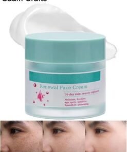 Saam Crafts Saam Renewal Face Cream, Saam Cosmetics Cream Dark Spots Cream, Saam Renewal Face Cream 50g For Melasma And Freckles Treatment For All Skin Types, Anti-Wrinkle Face Cream, Saam Face Cream Korean