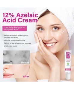 CARVENCHY 12% Azelaic Acid Serum, Hyaluronic Acid,Niacinamide and Vitamin C for Redness Relief Face, Dark Spot, Rosacea Acne, Balance Excess Sebum,Brightening Face Skin Care Treatment 20g